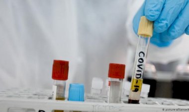 ABD'deki aşı deneyinde ilk sonuçlar olumlu