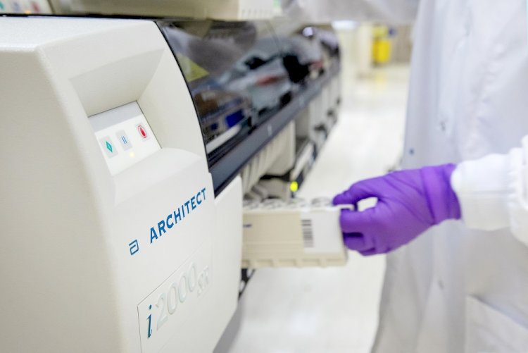 Koronavirüsle mücadelede yeni antikor testi artık Türkiye'de
