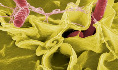 Kırmızı soğandan bulaşıyor: Şimdi de başımıza bu çıktı: Salmonella salgını paniği