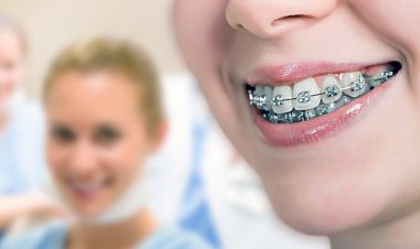 Ortodonti Tedavisinde Evde Acil Müdahaleler Nasıl Yapılır?