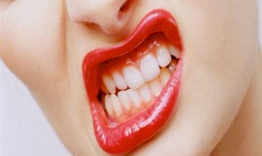 Gece dişlerimi sıkıyorum, Gece Plağı mı, Splint mi kullanmalıyım?14.6.1