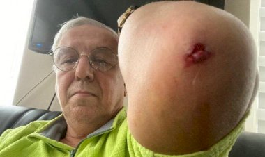 Ankara’da bir saldırı daha! Önce siyasetçi sonra da gazeteci dövüldü!