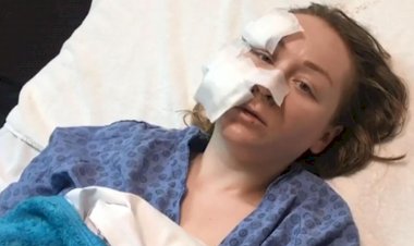 В турецком ТЦ муж порезал лицо 28-летней украинке (видео)