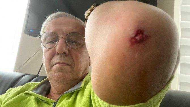 Ankara’da bir saldırı daha! Önce siyasetçi sonra da gazeteci dövüldü!