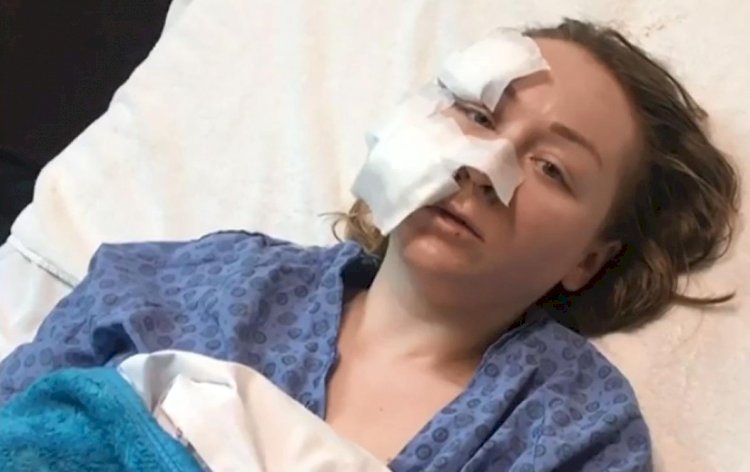 В турецком ТЦ муж порезал лицо 28-летней украинке (видео)