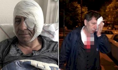 Saldırıya uğrayan, dayak yiyen gazeteciler kulübü