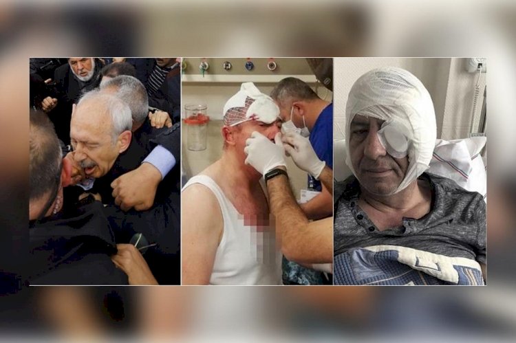 Gazeteci ve siyasilere yönelik saldırılar neden önlenemiyor? Özdağ: Bunların siyasi, emniyet ve yargı ayağı var