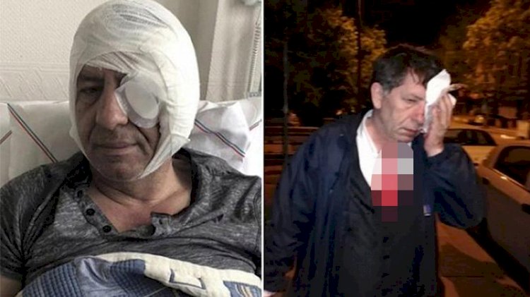 Saldırıya uğrayan, dayak yiyen gazeteciler kulübü