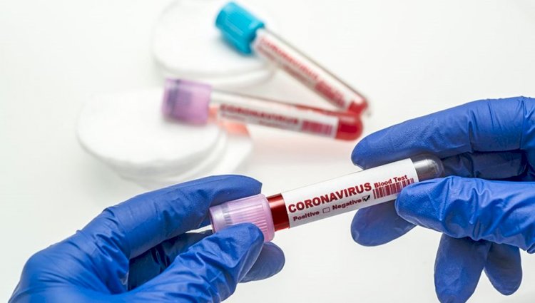 Koronavirüs kısıtlamaları sona eriyor ama virüs kapma riski nerelerde yüksek olacak?