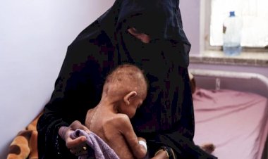 Milyonlarca insan açlıktan ölme tehlikesiyle karşı karşıya