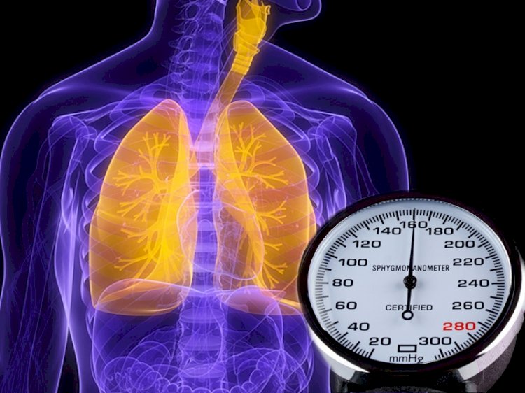 'Akciğer yüksek tansiyonu' hayatı tehdit eden bir hastalıktır