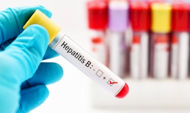Türkiye’de hepatit B virüsü taşıyan 3,5 milyon insan bulunuyor