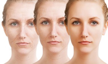 CİLT YAŞLANMASININ ÖNÜNE UZMAN ELLERDE YAPILAN ESTETİK MÜDAHALE İLE GEÇEBİLİRSİNİZ