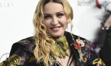 Instagram, Madonna'nın fotoğraflarını kaldırdı: "Meme ucu görünüyor"