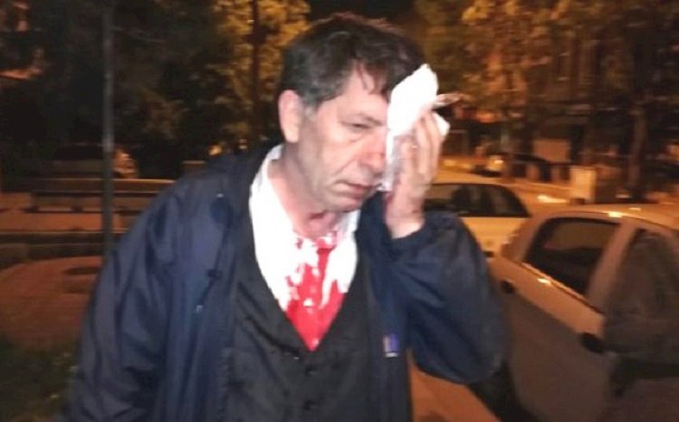 Solcu gazeteciler öldürüldü, Ülkücü gazeteciler dövülüyor...
