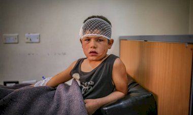 Misket bombalarıyla gelen vahşet! Esad çadır kampı vurdu