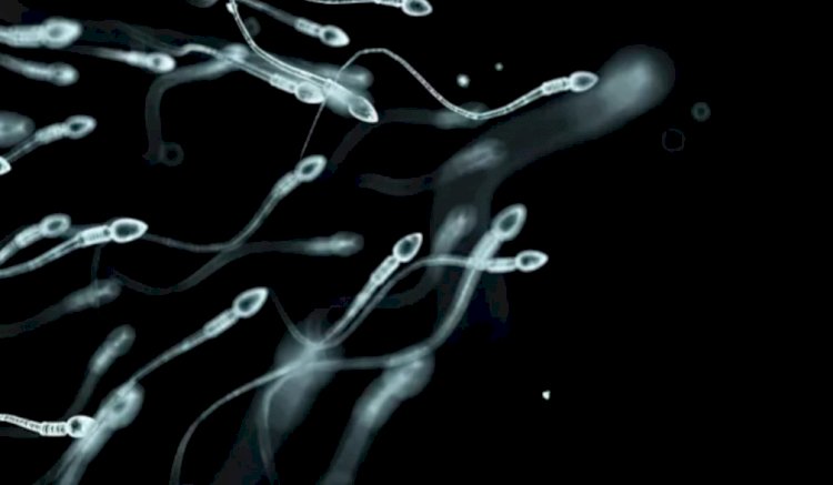 Erkeklerin sperm sayısı neden azalıyor? En büyük risk faktörleri neler?