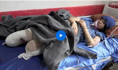 Video | İsrail bombardımanı altındaki Gazze'de ampute edilen çocuklar ve yarım kalan hayalleri
