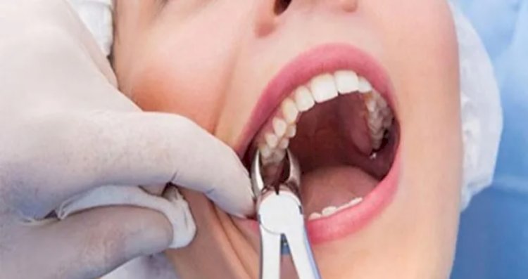 Genç yaşta diş kaybı yaşayabilirsiniz!