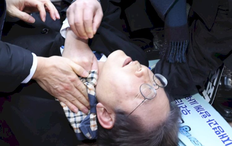 Güney Kore'de ana muhalefet lideri bıçaklı saldırıya uğradı, boynundan yaralandı