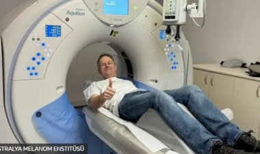 Beyin kanserine yakalanan onkoloğun kendisini tedavi etmek için 'çığır açıcı' mücadelesi