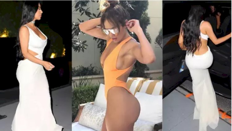 What is Brazilian Buttock (BBL) Aesthetics?