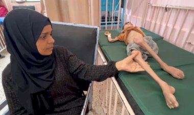 Gazze'de çocuklar kirli ve yetersiz su nedeniyle hastalanıyor