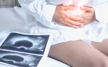 Yumurtalık Kisti Nedir? Belirtileri, Tedavi Yöntemleri ve Cerrahi Süreç