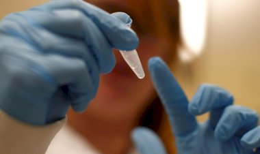 Obezite, hareketsizlik kanseri artırır, işlenmiş etlerden uzak durulmalı'