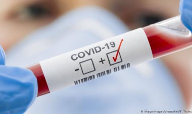 Dünyada Covid-19, Türkiye’de kuş gribi