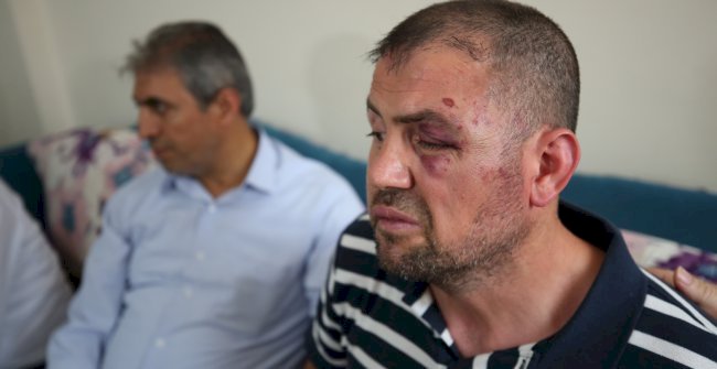 Bursa'da gaziyi hastanelik edenler tutuklandı
