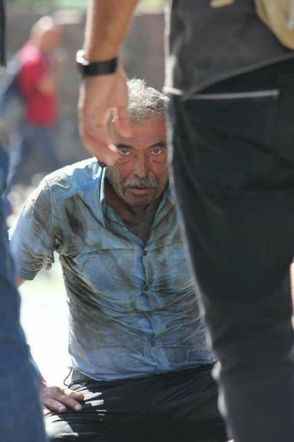 Ankara Kızılay Güvenpark'ta 45-50 yaşlarındaki bir kişi kendisini yaktı....