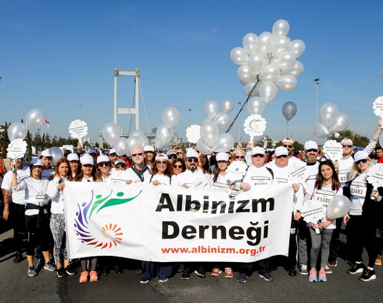 “Albinizmin farkında ol, varlığınla destek ol”