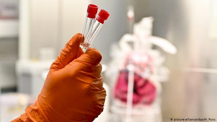 Koronavirüsten ölenlerin sayısı 170'e ulaştı